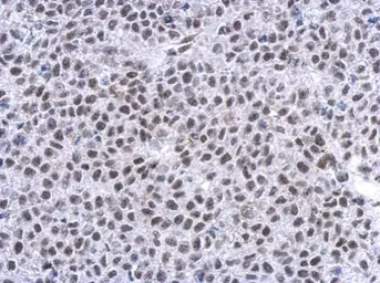 Anti-Glucocorticoid Receptor antibody used in IHC (Paraffin sections) (IHC-P). GTX101120