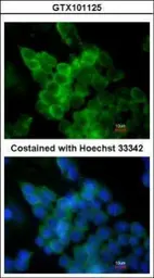 Anti-LPL antibody used in Immunocytochemistry/ Immunofluorescence (ICC/IF). GTX101125
