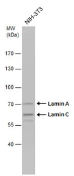 Anti-Lamin A + C antibody used in Western Blot (WB). GTX101126