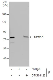 Anti-Lamin A + C antibody used in Immunoprecipitation (IP). GTX101126
