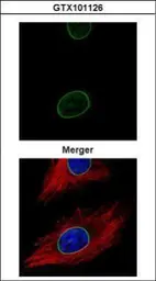 Anti-Lamin A + C antibody used in Immunocytochemistry/ Immunofluorescence (ICC/IF). GTX101126