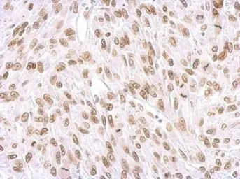 Anti-Lamin A + C antibody used in IHC (Paraffin sections) (IHC-P). GTX101126