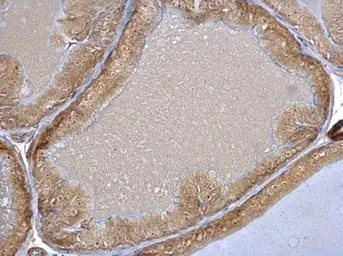 Anti-HSC70 antibody used in IHC (Paraffin sections) (IHC-P). GTX101144
