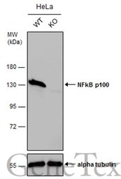 Anti-NFkB p100 antibody [C2C3], C-term used in Western Blot (WB). GTX101150