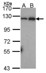Anti-NFkB p100 antibody [C2C3], C-term used in Western Blot (WB). GTX101150