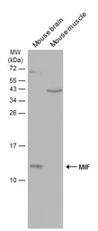 Anti-MIF antibody [N1C3] used in Western Blot (WB). GTX101162