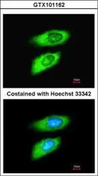 Anti-MIF antibody [N1C3] used in Immunocytochemistry/ Immunofluorescence (ICC/IF). GTX101162