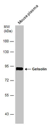 Anti-Gelsolin antibody [C2C3], C-term used in Western Blot (WB). GTX101185