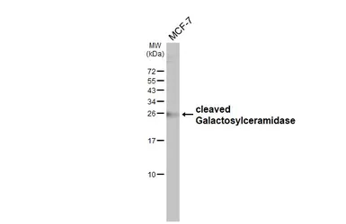 Anti-Galactosylceramidase antibody [N3C3] used in Western Blot (WB). GTX101197