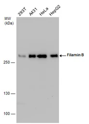 Anti-Filamin B antibody [N1], N-term used in Western Blot (WB). GTX101206