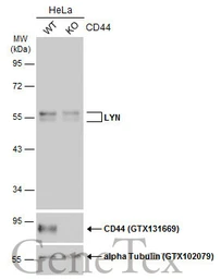Anti-LYN antibody used in Western Blot (WB). GTX101222