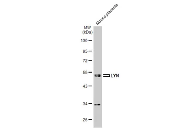 Anti-LYN antibody used in Western Blot (WB). GTX101222