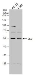 Anti-DLD antibody used in Western Blot (WB). GTX101245