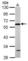 Anti-DLD antibody used in Western Blot (WB). GTX101245