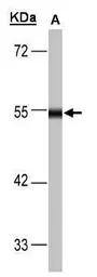 Anti-DLD antibody used in Western Blot (WB). GTX101245