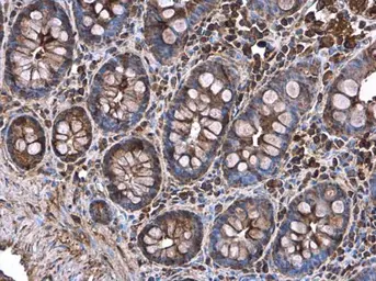 Anti-Decorin antibody used in IHC (Paraffin sections) (IHC-P). GTX101247
