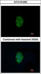 Anti-Decorin antibody used in Immunocytochemistry/ Immunofluorescence (ICC/IF). GTX101250
