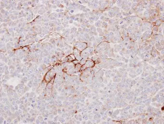 Anti-Decorin antibody used in IHC (Paraffin sections) (IHC-P). GTX101250