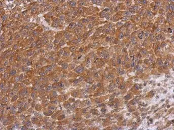 Anti-Dysbindin antibody used in IHC (Paraffin sections) (IHC-P). GTX101252