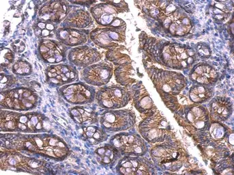Anti-beta Catenin antibody used in IHC (Paraffin sections) (IHC-P). GTX101254