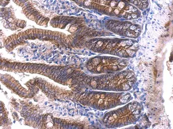Anti-beta Catenin antibody used in IHC (Paraffin sections) (IHC-P). GTX101254