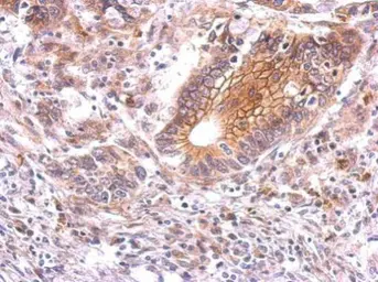 Anti-beta Catenin antibody used in IHC (Paraffin sections) (IHC-P). GTX101254