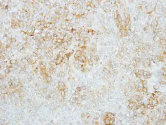 Anti-GBA antibody [C1C3] used in IHC (Paraffin sections) (IHC-P). GTX101267