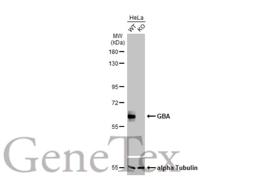 Anti-GBA antibody [C1C3] used in Western Blot (WB). GTX101267