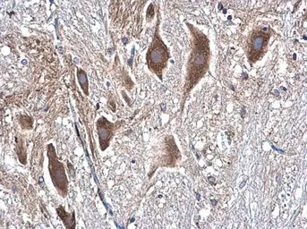 Anti-beta Tubulin antibody used in IHC (Paraffin sections) (IHC-P). GTX101279