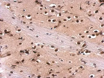 Anti-MEF2A antibody [C2C3], C-term used in IHC (Paraffin sections) (IHC-P). GTX101286