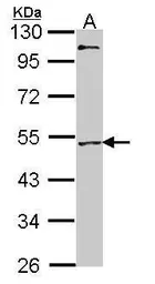 Anti-MEF2A antibody [C2C3], C-term used in Western Blot (WB). GTX101286