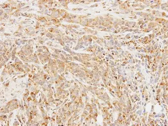 Anti-BCHE antibody [N1N3] used in IHC (Paraffin sections) (IHC-P). GTX101304