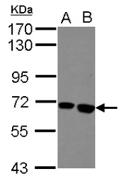 Anti-BCHE antibody [N1N3] used in Western Blot (WB). GTX101304