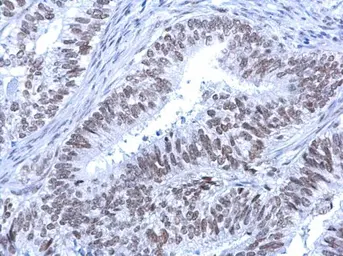 Anti-ATRX antibody [C3], C-term used in IHC (Paraffin sections) (IHC-P). GTX101310
