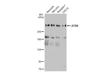 Anti-ATRX antibody [C3], C-term used in Western Blot (WB). GTX101310