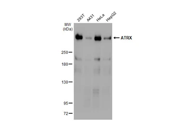 Anti-ATRX antibody [C3], C-term used in Western Blot (WB). GTX101310