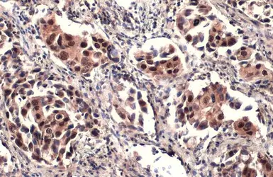 Anti-ATRX antibody [C3], C-term used in IHC (Paraffin sections) (IHC-P). GTX101310