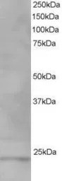 Anti-VPS28 antibody, C-term used in Western Blot (WB). GTX10133