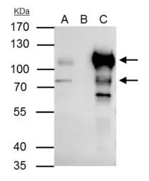 Anti-BCL6 antibody [N2C1], Internal used in Immunoprecipitation (IP). GTX101338