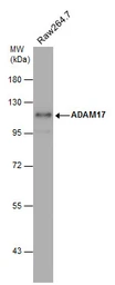 Anti-ADAM17 antibody [C2C3], C-term used in Western Blot (WB). GTX101358