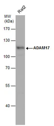 Anti-ADAM17 antibody [C2C3], C-term used in Western Blot (WB). GTX101358