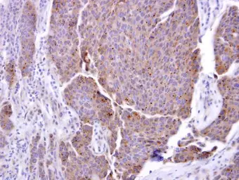 Anti-ADAM17 antibody [C2C3], C-term used in IHC (Paraffin sections) (IHC-P). GTX101358