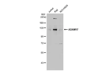 Anti-ADAM17 antibody [C2C3], C-term used in Western Blot (WB). GTX101358