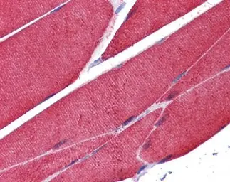 Anti-alpha Skeletal Muscle Actin antibody used in IHC (Paraffin sections) (IHC-P). GTX101362