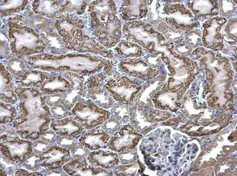Anti-ACADM antibody used in IHC (Paraffin sections) (IHC-P). GTX101393