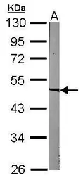 Anti-ACADM antibody used in Western Blot (WB). GTX101393
