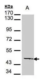 Anti-ACADM antibody used in Western Blot (WB). GTX101393