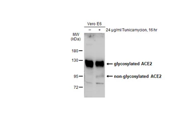 Anti-ACE2 antibody [N1N2], N-term used in Western Blot (WB). GTX101395