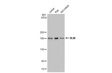 Anti-BLM antibody [N1N2], N-term used in Western Blot (WB). GTX101403