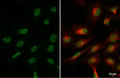 Anti-BLM antibody [N1N2], N-term used in Immunocytochemistry/ Immunofluorescence (ICC/IF). GTX101403